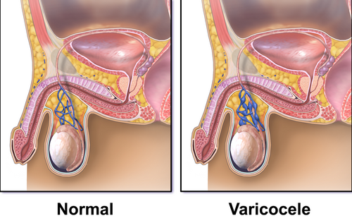 premature-ejaculation-treatment-in-noida