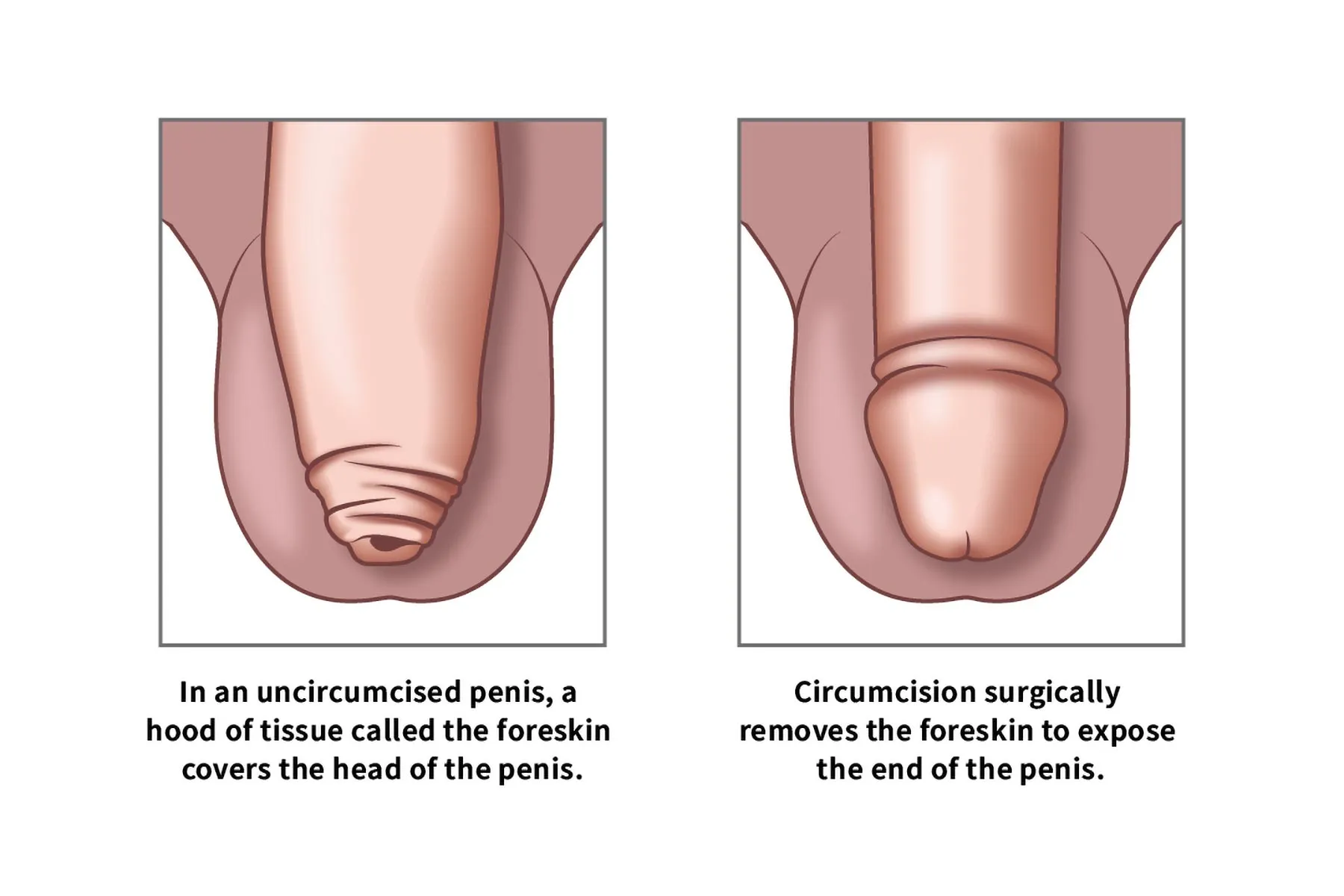 premature-ejaculation-treatment-in-noida