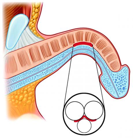 premature-ejaculation-treatment-in-noida
